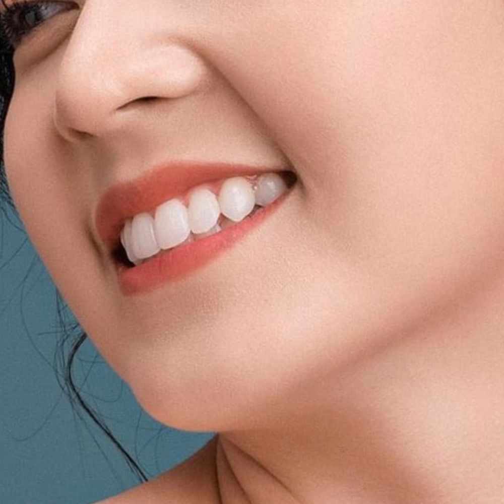 Kem Đánh Răng Median IQ 93% Trắng Răng Màu Đỏ 120g