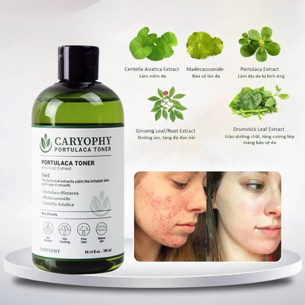Nước Hoa Hồng Chăm Sóc Da Dầu Mụn Caryophy Portulaca Toner 300ml