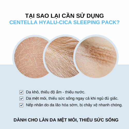 Mặt Nạ Ngủ Cấp Ẩm Sáng Da Ngừa Lão Hóa Skin1004 Madagascar Centella Hyalu-cica Sleeping Pack 100ml