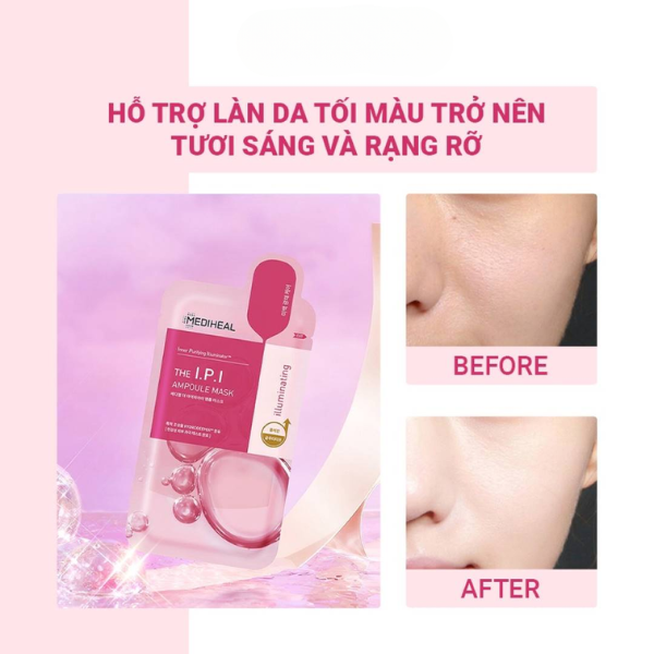 Mặt Nạ Dưỡng Sáng Làm Dịu Và Cấp Ẩm Da Mediheal Centella Niacin Ampoule Mask