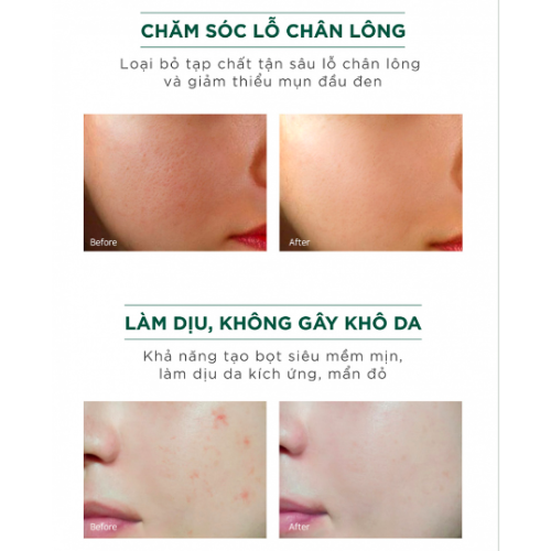 Sữa Rửa Mặt Làm Sạch Sâu, Phục Hồi Da Caryophy Portulaca Cleansing Foam 150ml