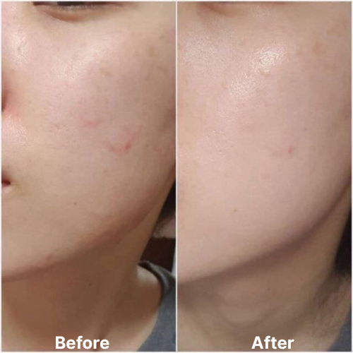 Kem Dưỡng Làm Dịu Da Chiết Xuất Rau Má Skin1004 Madagascar Centella Soothing Cream