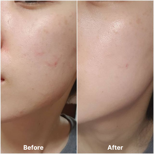 Kem Chống Nắng Cho Da Nhạy Cảm Skin1004 Madagascar Centella Air-Fit Suncream Plus Spf50+ Pa++++