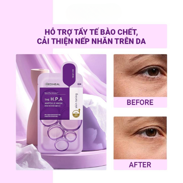 Mặt Nạ Dưỡng Sáng Làm Dịu Và Cấp Ẩm Da Mediheal Centella Niacin Ampoule Mask