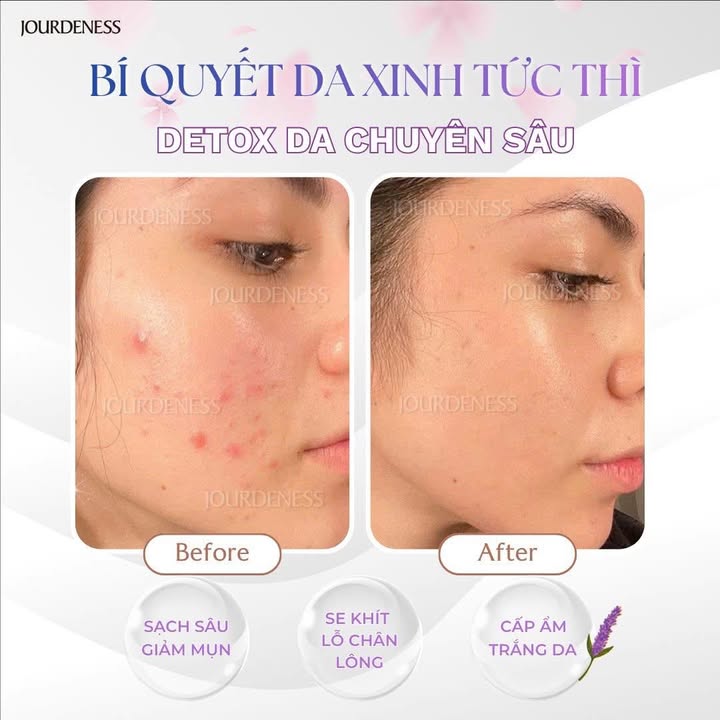 ✨ LIỆU TRÌNH ĐẸP DA – DETOX DA MẶT KIỂU PHÁP 40 PHÚT ✨
