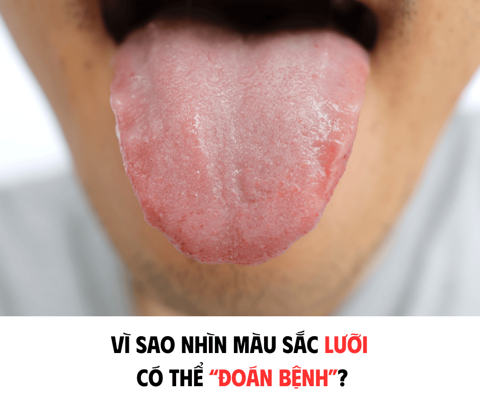 VÌ SAO NHÌN MÀU SẮC LƯỠI CÓ THỂ 