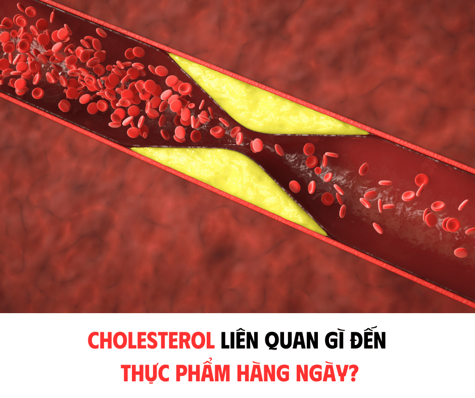 CHOLESTEROL LIÊN QUAN GÌ ĐẾN THỰC PHẨM HÀNG HÀNG?