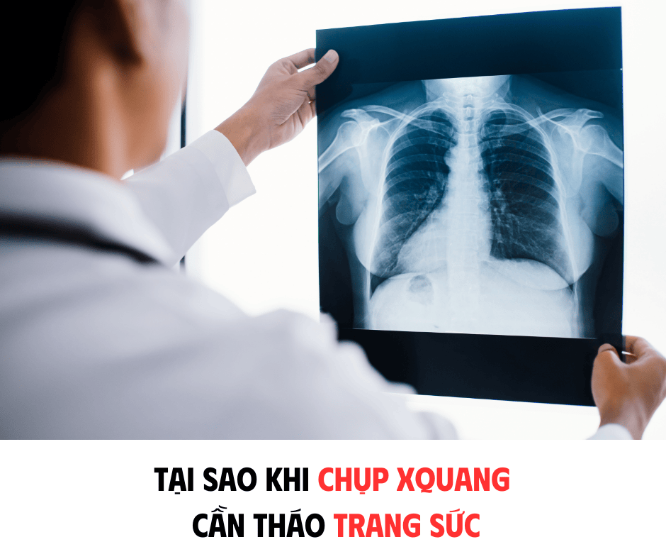 TẠI SAO KHI CHỤP XQUANG CẦN THÁO TRANG SỨC