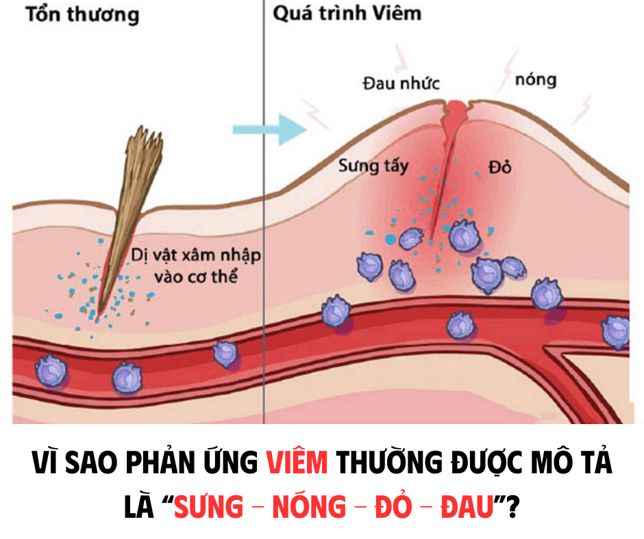 VÌ SAO PHẢN ỨNG VIÊM THƯỜNG ĐƯỢC MÔ TẢ LÀ