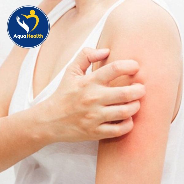 Những dấu hiệu cho thấy bạn bị dị ứng với nước máy