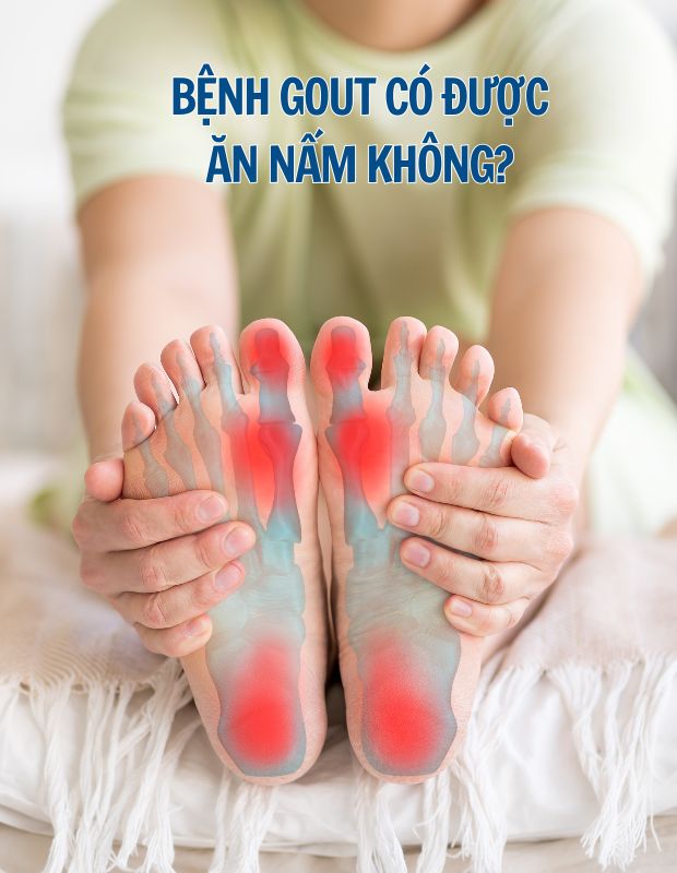 Bệnh gout có được ăn nấm không? Người bệnh gout nên và không nên ăn gì?