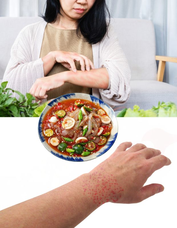 Dị ứng sứa biển: Triệu chứng nhận biết và cách xử lý an toàn