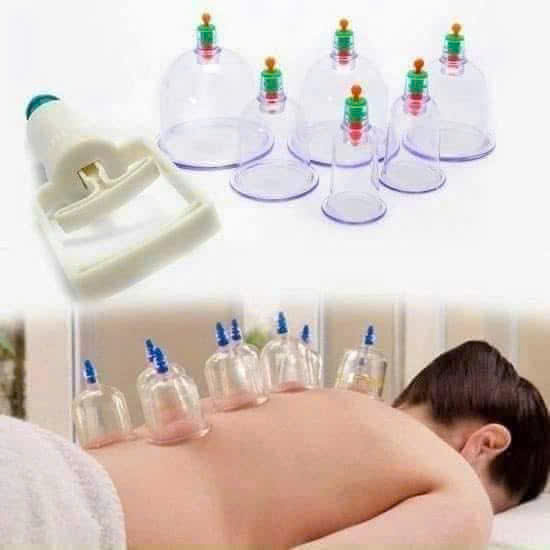 Bộ Giác Hơi 12 Món Không dùng Lửa Có Dây Nối