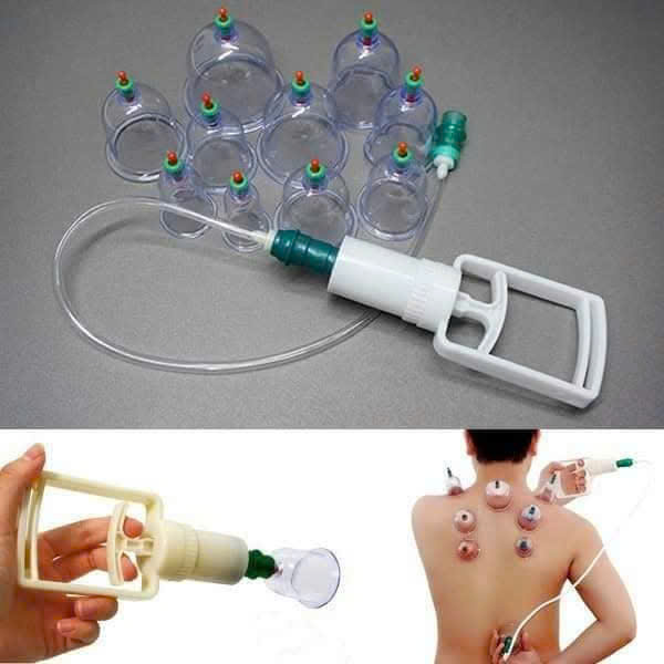 Bộ Giác Hơi 12 Món Không dùng Lửa Có Dây Nối
