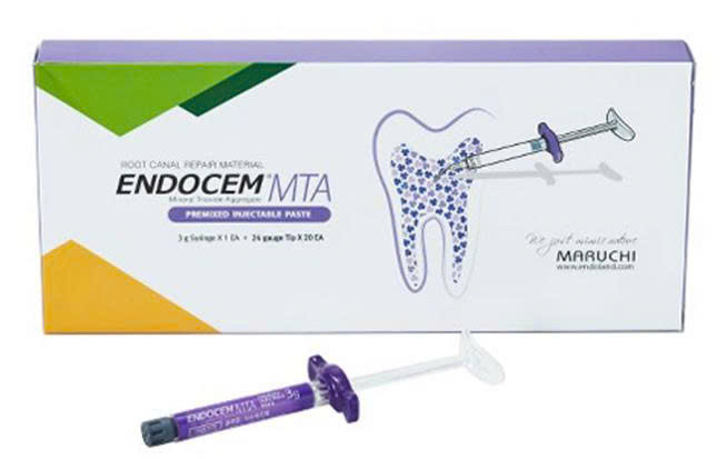 EndoCem MTA – Vật liệu nha khoa tiên tiến trong điều trị nội nha