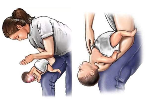 Trẻ hóc dị vật đường thở và cách xử trí nhanh tại nhà