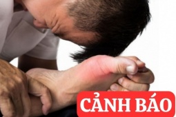 6 thói quen tàn phá xương khớp tưởng vô hại nhưng cực nguy hiểm