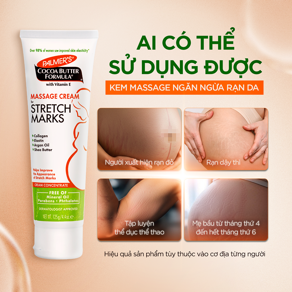Kem ngăn ngừa và hỗ trợ làm mờ rạn da cho mẹ bầu giữa thai kỳ Palmer's 125g