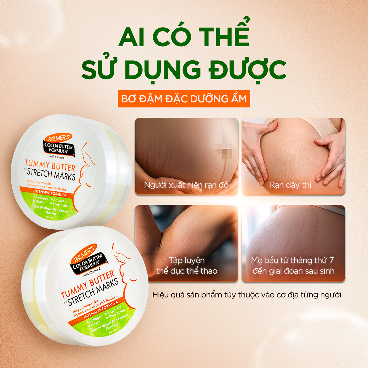 Bơ đậm đặc ngăn ngừa và hỗ trợ làm mờ rạn da cho mẹ bầu cuối thai kỳ và sau sinh Palmer's 125g