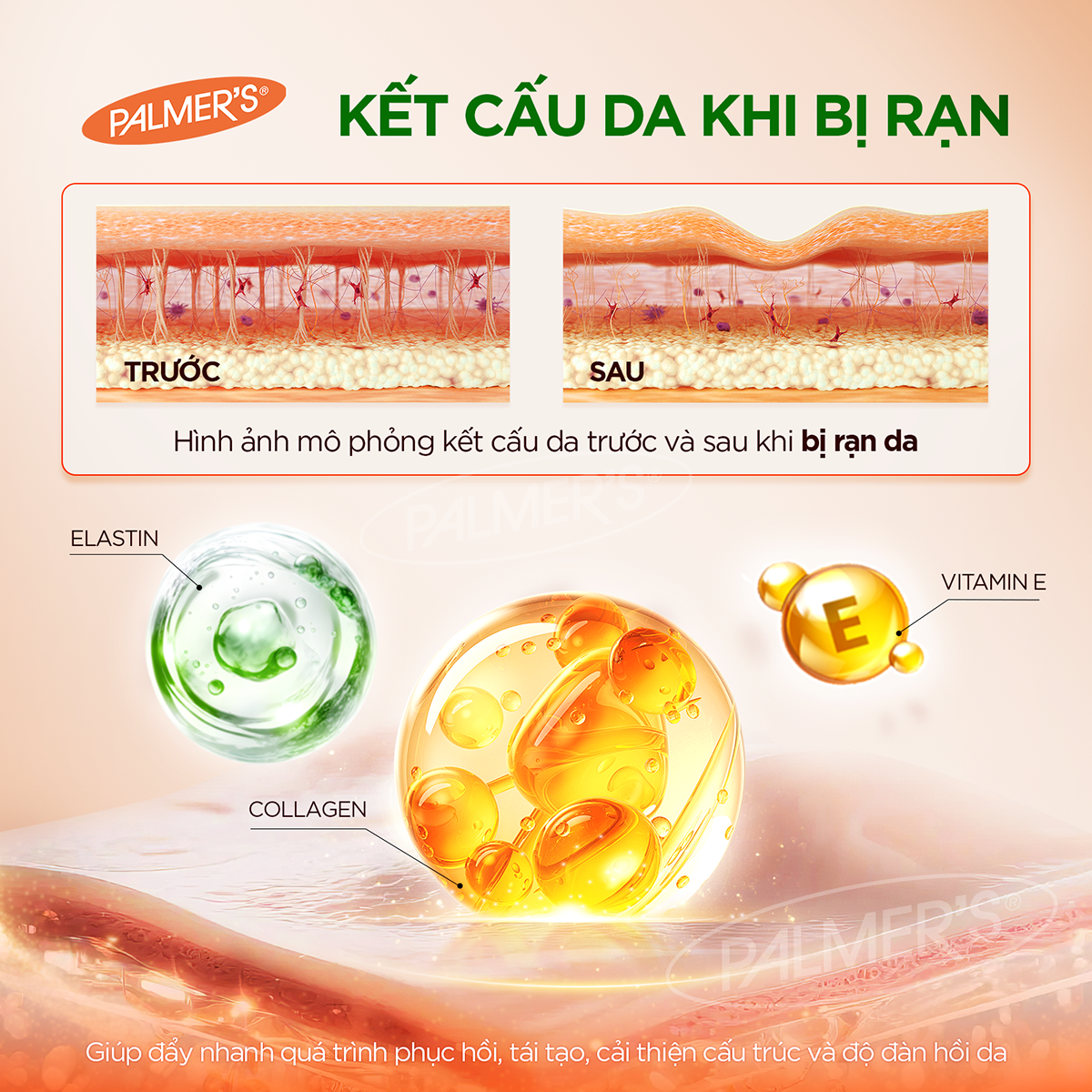 Bơ đậm đặc ngăn ngừa và hỗ trợ làm mờ rạn da cho mẹ bầu cuối thai kỳ và sau sinh Palmer's 125g
