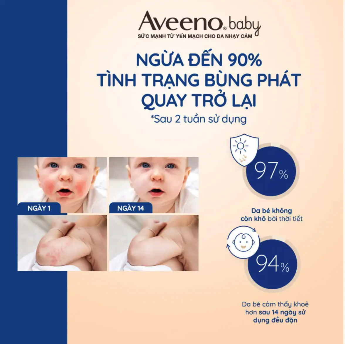 Sữa dưỡng ẩm cho bé Aveeno Baby Daily Moisture Lotion 227g