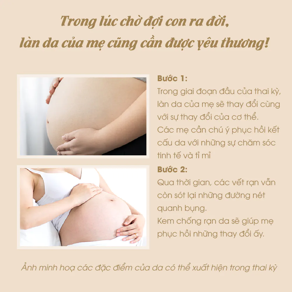 Kem Chống Rạn Thuần Chay Belly Cream ATONO2 200ml