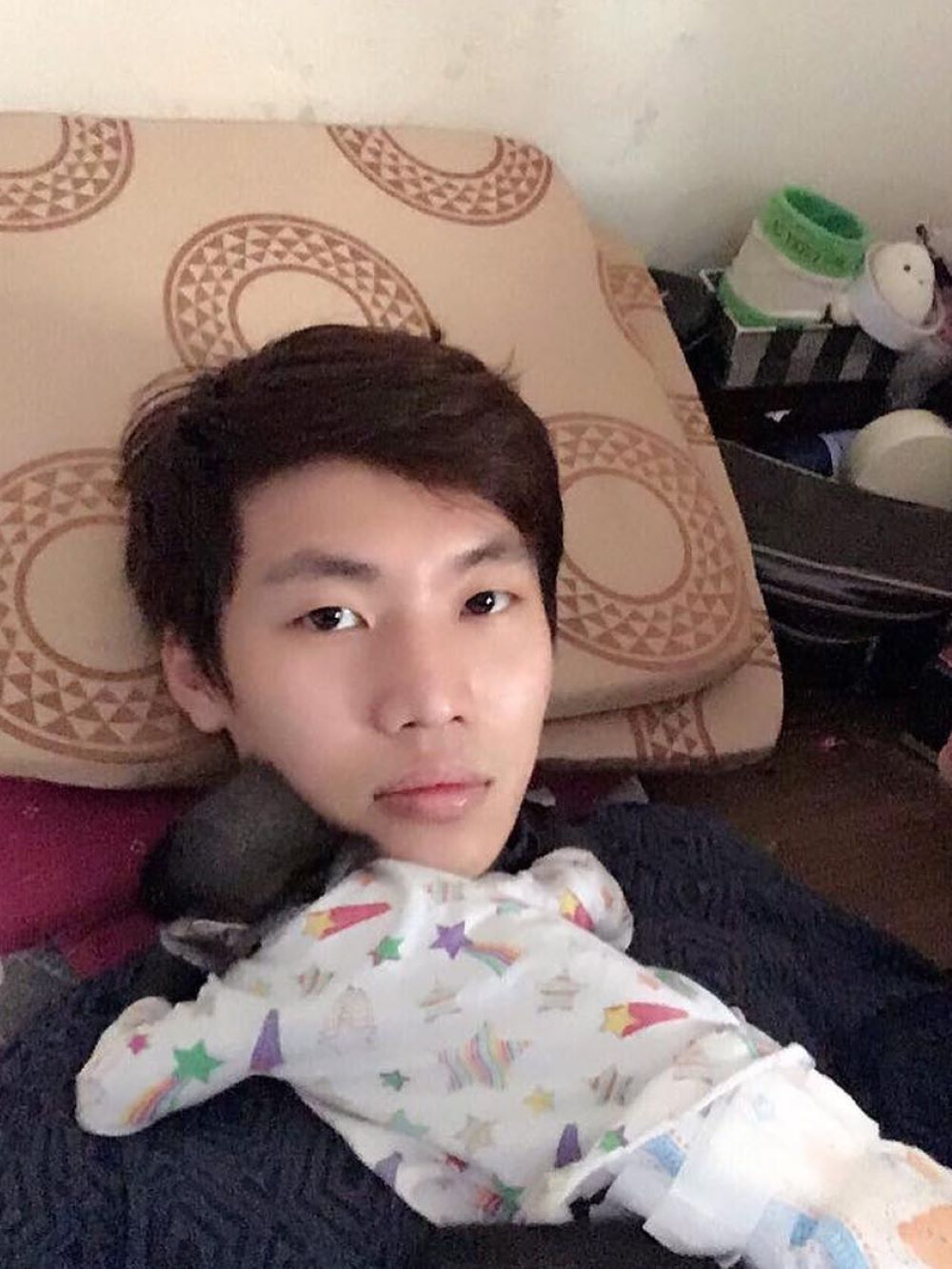 chàng tiên cá Tiun cắt mắt 2 mí