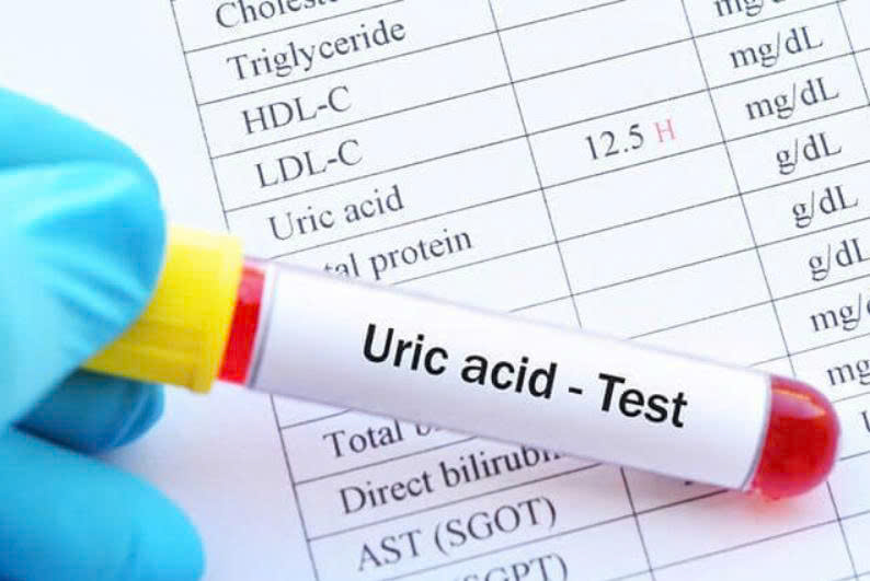 Axit uric bao nhiêu là bị gout? Nguyên nhân, triệu chứng và cách khắc phục