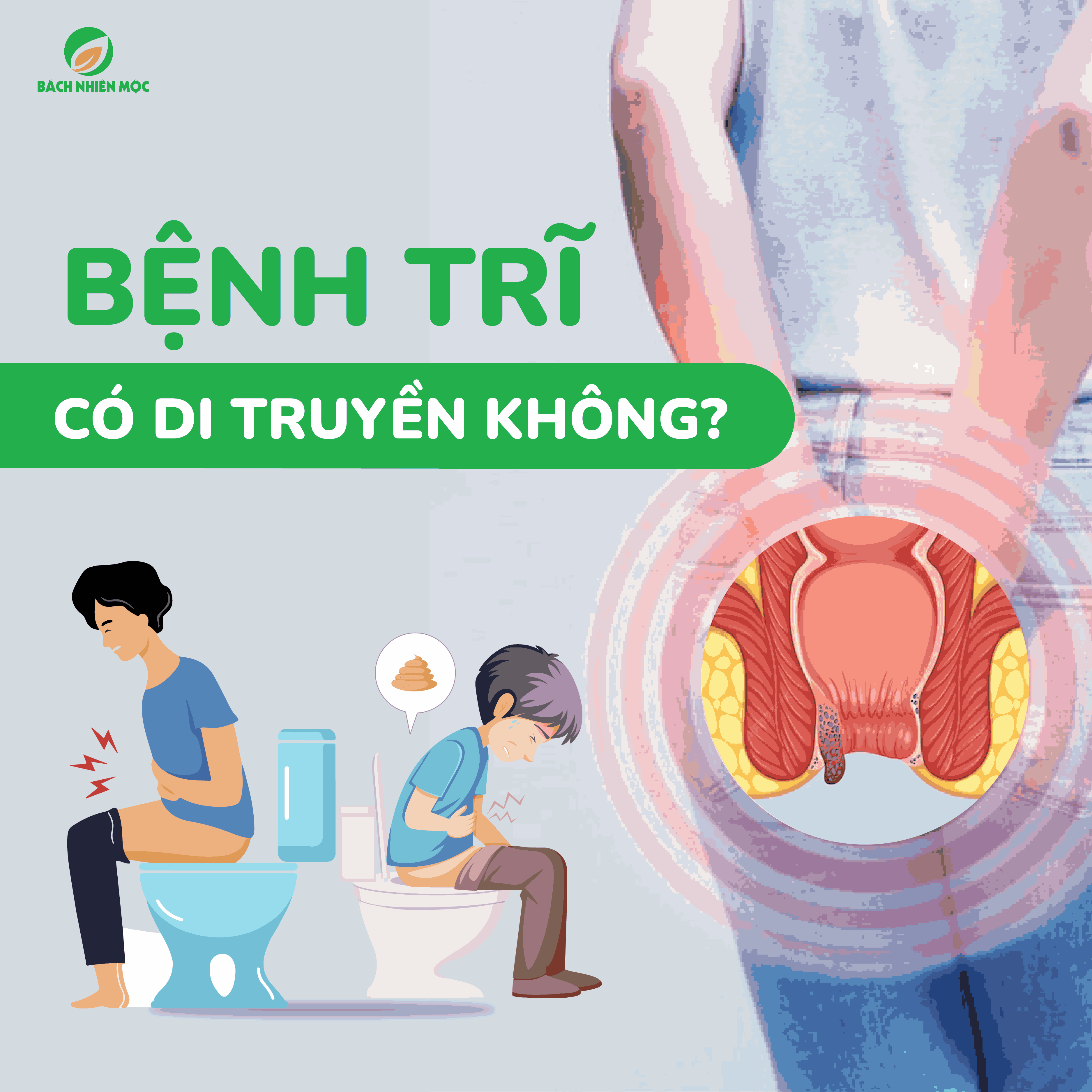 Bệnh trĩ có di truyền không? Cách phòng ngừa, nên ăn gì?