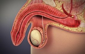 Cách chữa rối loạn cương dương do thủ dâm