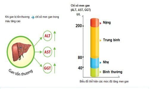 Chỉ số AST và ALT trong đánh giá chức năng gan: Hiểu đúng để bảo vệ sức khỏe