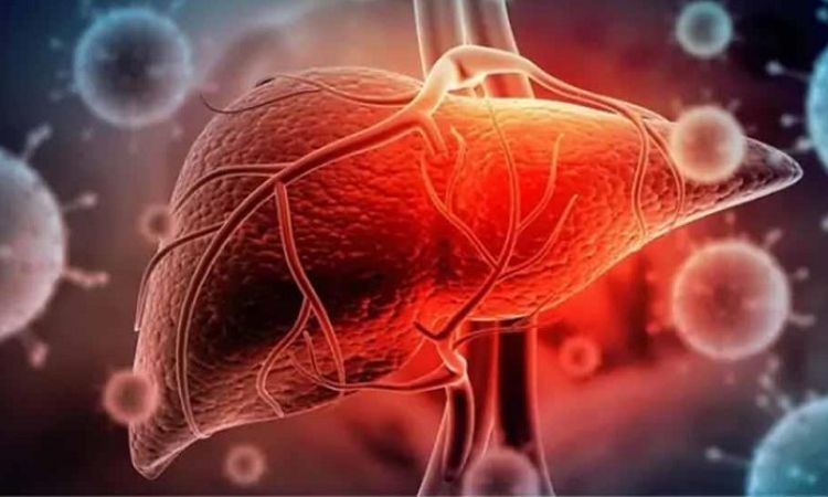 Dấu hiệu suy gan cấp: Nhận biết sớm để phòng tránh biến chứng nguy hiểm