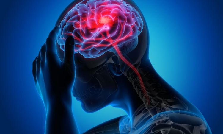 Đau nửa đầu – Hiểu đúng cơ chế để chữa đúng cách