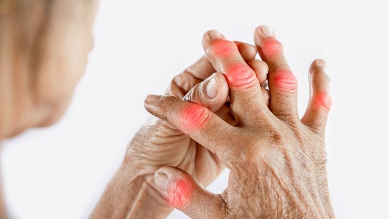 Gút thường đau ở đâu?