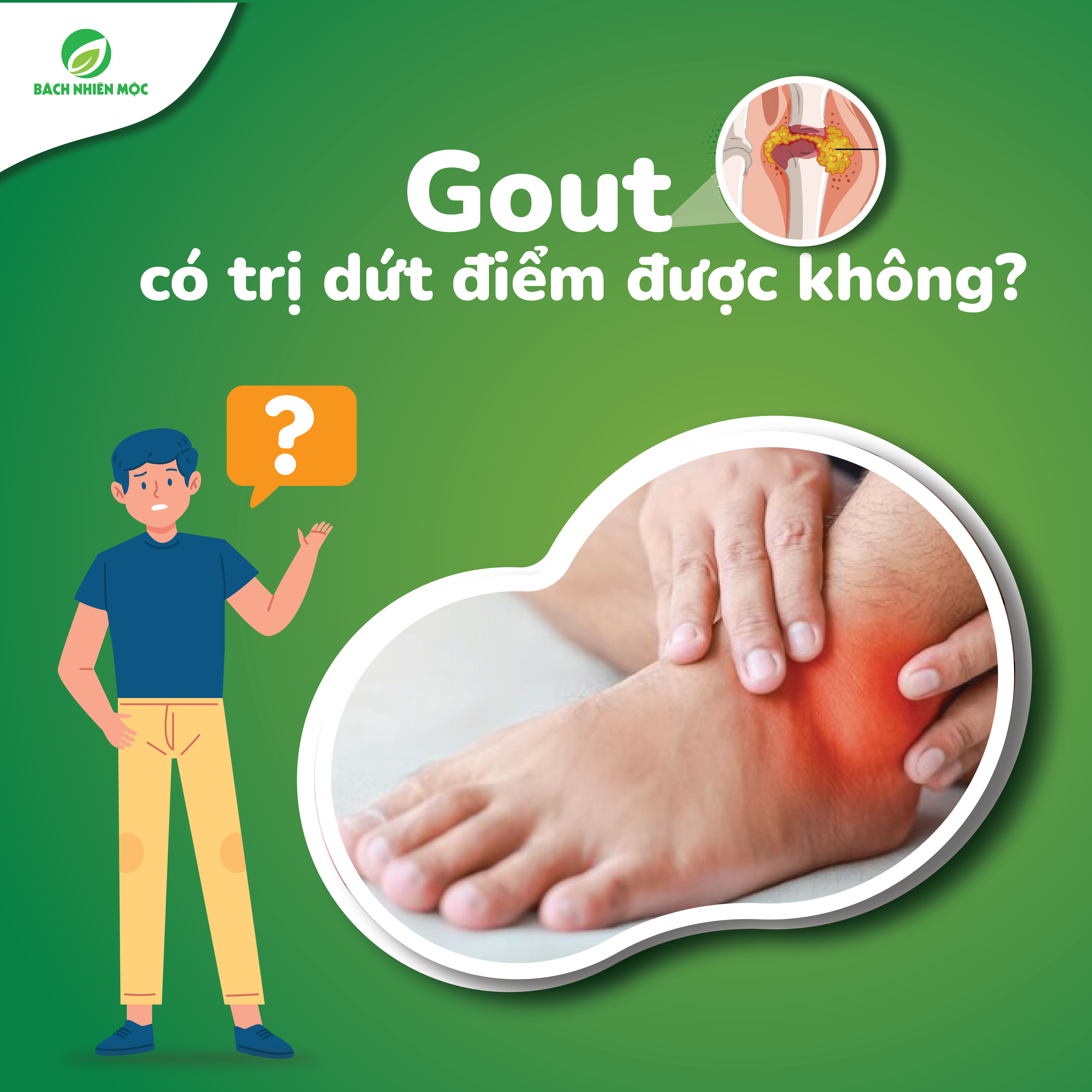Gout có trị dứt điểm được không