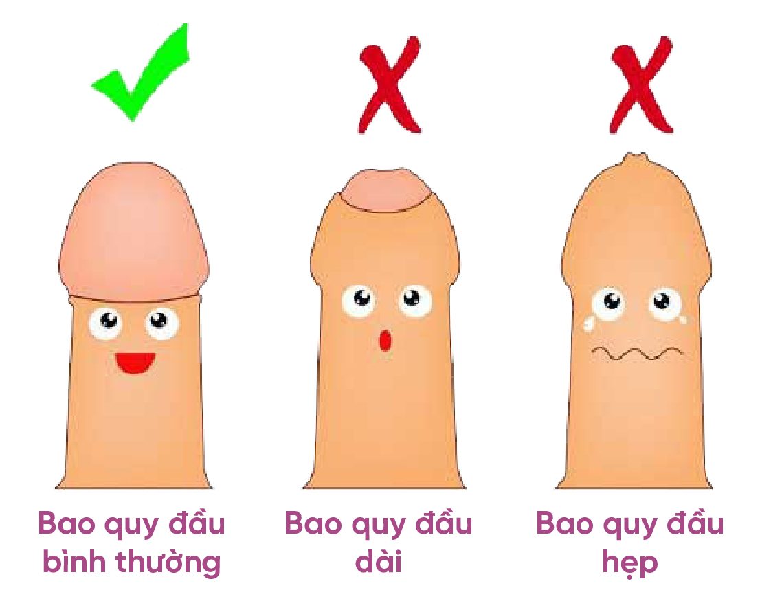 Hẹp Bao Quy Đầu Có Gây Xuất Tinh Sớm Không? Giải Đáp Toàn Diện
