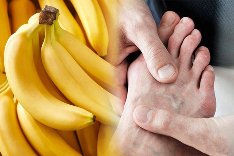 Bệnh gout ăn chuối được không? Giải đáp từ chuyên gia dinh dưỡng