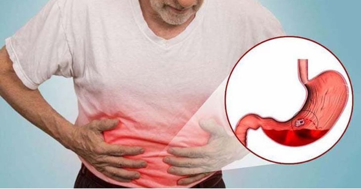 Nguyên nhân đau dạ dày: 6 thủ phạm âm thầm gây bệnh mà bạn cần tránh ngay