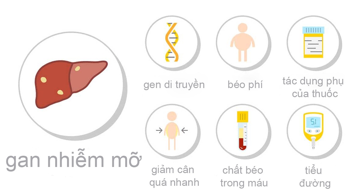 Nguyên nhân gan nhiễm mỡ: Hiểu đúng để phòng ngừa và điều trị hiệu quả