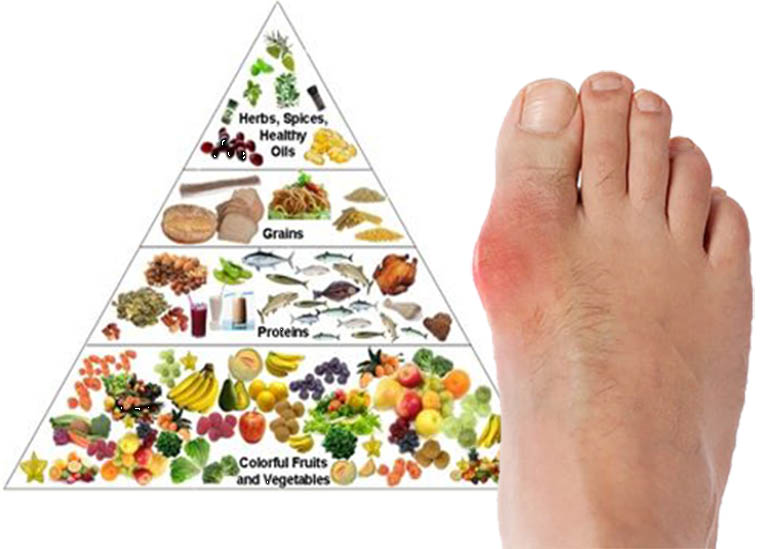 Cách giảm axit uric tự nhiên, an toàn