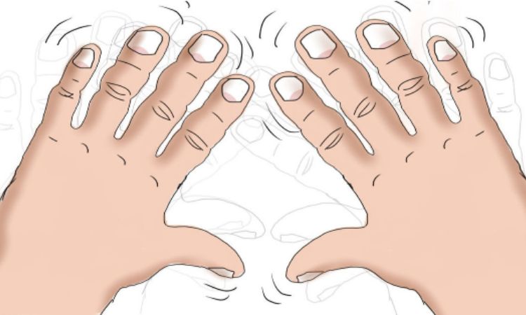 Run chân tay: Nguyên nhân, triệu chứng và cách điều trị