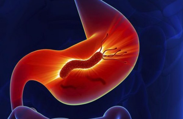 Viêm dạ dày dạng nốt là gì?