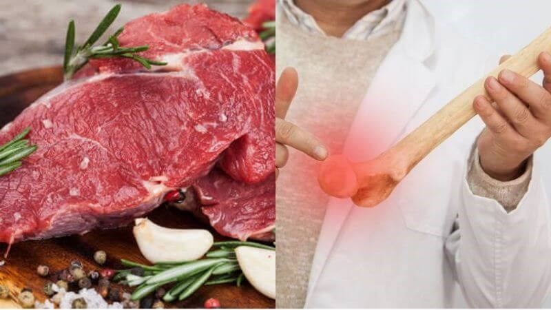 Viêm khớp ăn thịt bò được không? Giải đáp chi tiết và lời khuyên