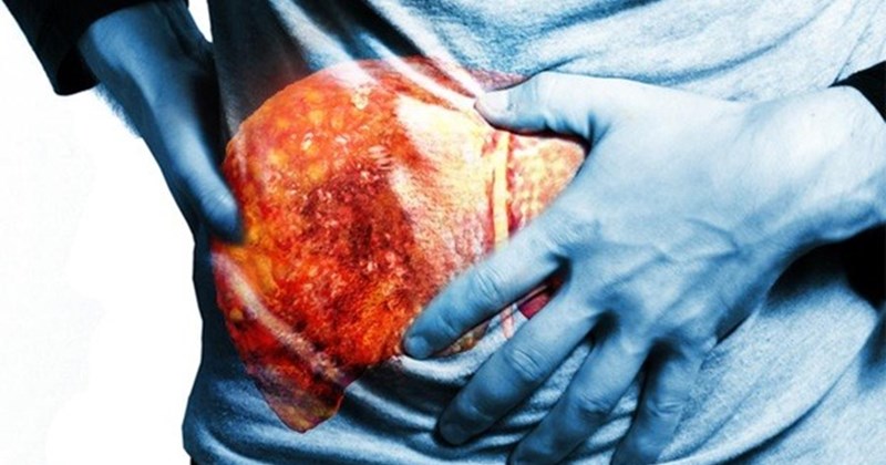 Xơ gan có chữa được không? Tìm hiểu nguyên nhân, giai đoạn và phương pháp điều trị hiệu quả