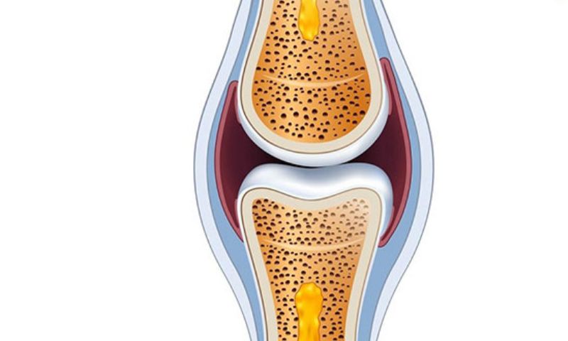 Nguyên nhân khiếp khớp bị khô