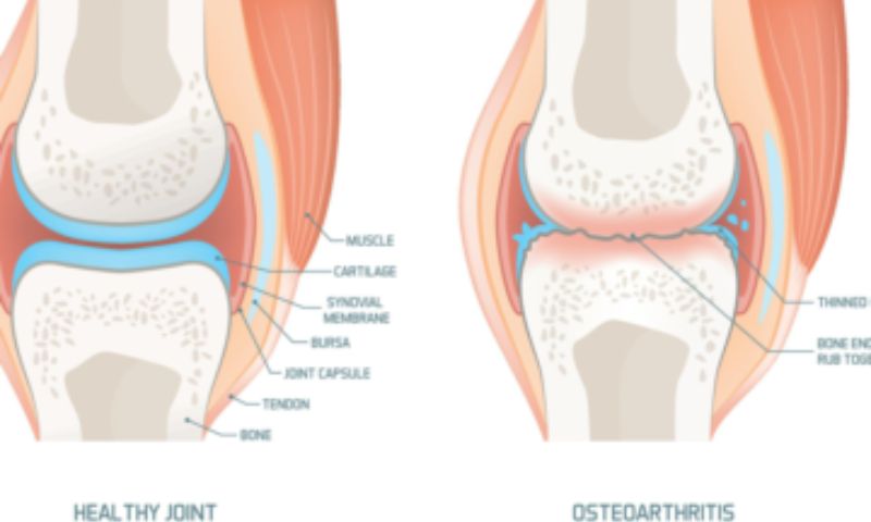 Dưỡng chất cần thiết cho xương khớp