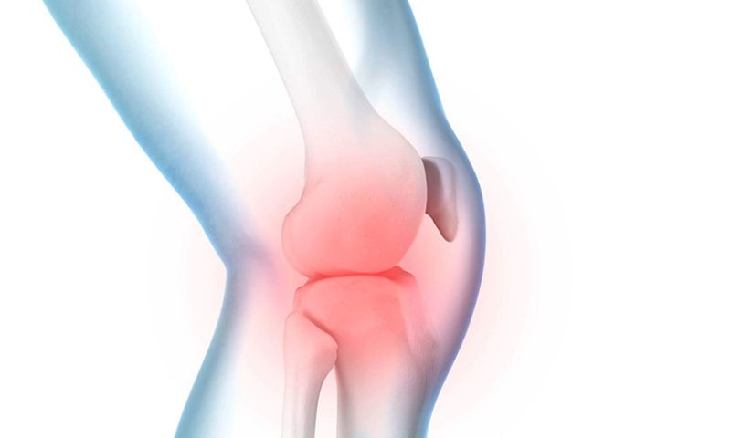 Điều trị viêm bao hoạt dịch khớp