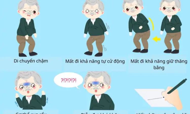 Dấu hiệu bệnh Parkinson sớm