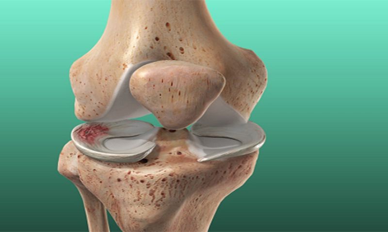 Phương pháp điều trị khô khớp