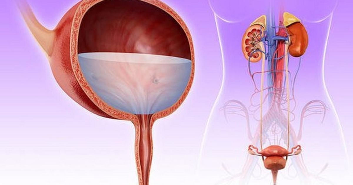 Điều trị viêm bàng quang hiệu quả